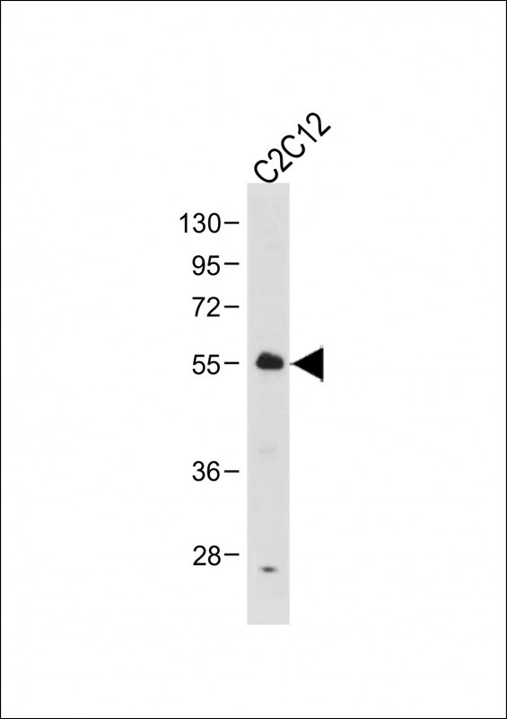 Anti-SMAD2-T220 Antibody at 1:1000 dilution + C2C12 whole cell lysateLysates/proteins at 20 �g per lane.  SecondaryGoat Anti-Rabbit IgG,   (H+L),  Peroxidase conjugated at 1/10000 dilution.  Predicted band size : 52 kDaBlocking/Dilution buffer: 5% NFDM/TBST.