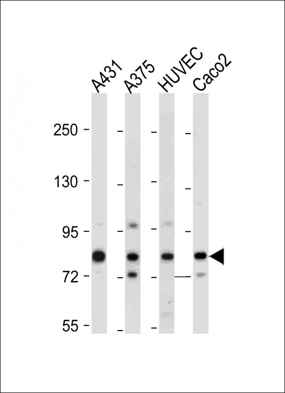 All lanes : Anti-AMOTL2 Antibody (Center) at 1:2000 dilutionLane 1: A431 whole cell lysateLane 2: A375 whole cell lysateLane 3: HUVEC whole cell lysateLane 4: Caco2 whole cell lysateLysates/proteins at 20 �g per lane. SecondaryGoat Anti-Rabbit IgG,  (H+L), Peroxidase conjugated at 1/10000 dilution. Predicted band size : 86 kDaBlocking/Dilution buffer: 5% NFDM/TBST.