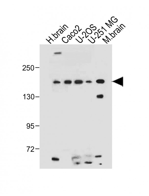 All lanes : Anti-TNIK(S764) Antibody at 1:500 dilutionLane 1: Human brain tissue lysateLane 2: Caco2 whole cell lysateLane 3: U-2 OS whole cell lysateLane 4: U-251 MG whole cell lysateLane 5: Mouse brain tissue lysateLysates/proteins at 20 �g per lane. SecondaryGoat Anti-Rabbit IgG,  (H+L), Peroxidase conjugated at 1/10000 dilution. Predicted band size : 155 kDaBlocking/Dilution buffer: 5% NFDM/TBST.