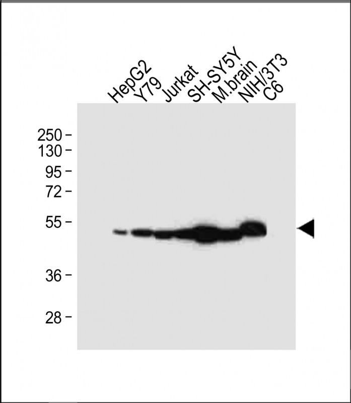 All lanes : Anti-NSE Antibody (Y25) at 1:4000 dilutionLane 1: HepG2 whole cell lysateLane 2: Y79 whole cell lysateLane 3: Jurkat whole cell lysateLane 4: SH-SY5Y whole cell lysateLane 5: Mouse brain tissue lysateLane 6: NIH/3T3 whole cell lysateLane 7: C6 whole cell lysateLysates/proteins at 20 �g per lane. SecondaryGoat Anti-Rabbit IgG,  (H+L), Peroxidase conjugated at 1/10000 dilution. Predicted band size : 47 kDaBlocking/Dilution buffer: 5% NFDM/TBST.
