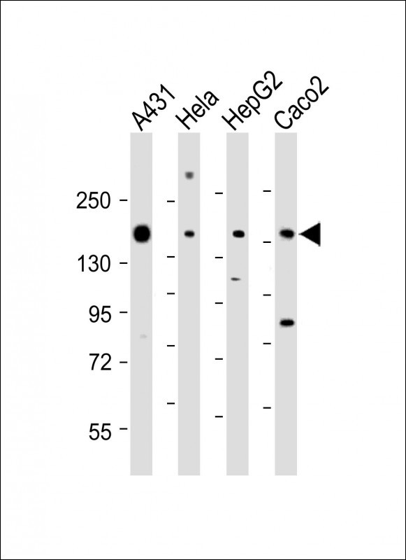 All lanes : Anti-CCK4 (PTK7) Antibody (N-term) at 1:1000-1:2000 dilutionLane 1: A431 whole cell lysateLane 2: Hela whole cell lysateLane 3: HepG2 whole cell lysateLane 4: Caco2 whole cell lysateLysates/proteins at 20 �g per lane. SecondaryGoat Anti-Rabbit IgG,  (H+L), Peroxidase conjugated at 1/10000 dilution. Predicted band size : 118 kDaBlocking/Dilution buffer: 5% NFDM/TBST.