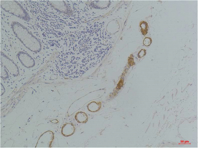 IHC - GRIK2 (GluR6) Polyclonal Antibody AP63690