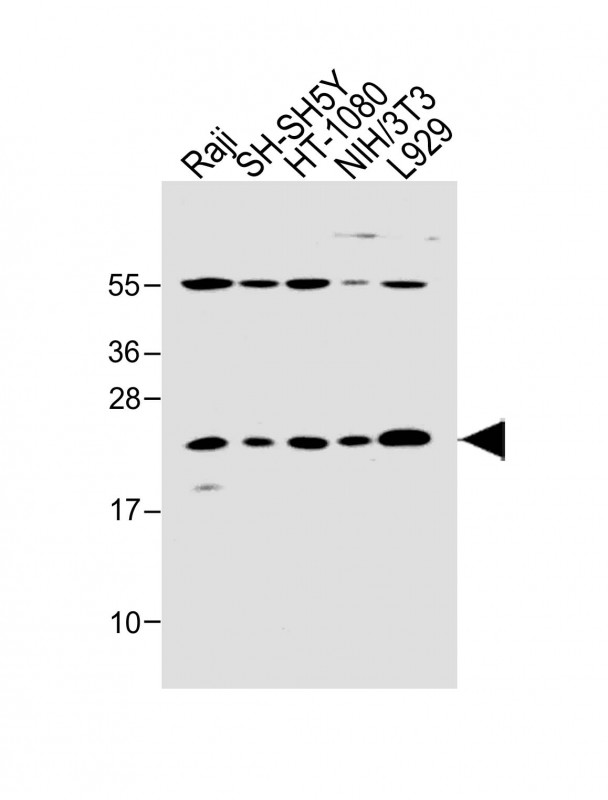 All lanes : Anti-Bax Antibody (BH3 Domain Specific) at 1:2000 dilutionLane 1: Raji whole cell lysateLane 2: SH-SH5Y whole cell lysateLane 3: HT-1080 whole cell lysateLane 4: NIH/3T3 whole cell lysateLane 5: L929 whole cell lysateLysates/proteins at 20 �g per lane. SecondaryGoat Anti-Rabbit IgG,  (H+L), Peroxidase conjugated at 1/10000 dilution. Predicted band size : 21 kDaBlocking/Dilution buffer: 5% NFDM/TBST.
