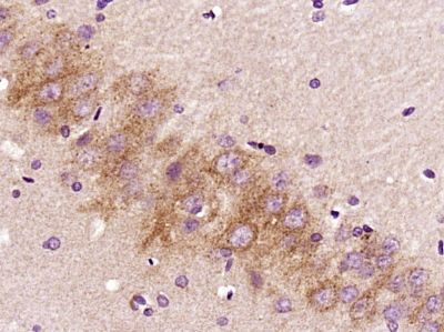 IHC-P - FBXO44 Polyclonal Antibody AP56092