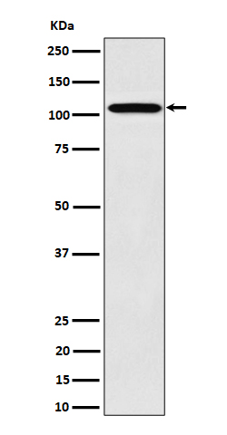 WB - Anti-Nup107 Rabbit Monoclonal Antibody ABO16432