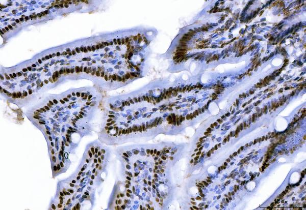 IHC - Anti-CTBP2 Antibody Picoband™ (monoclonal, 7F3E1) ABO16619