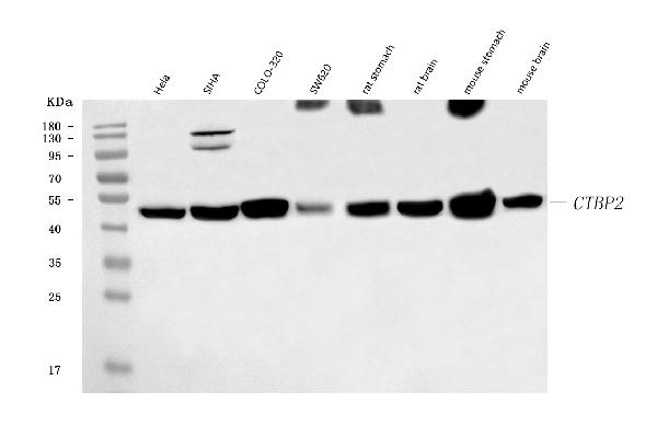 WB - Anti-CTBP2 Antibody Picoband™ (monoclonal, 7F3E1) ABO16619