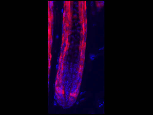 IF - Anti-RFP (RABBIT) Antibody Min X Hu Ms and Rt Serum Proteins ASR5194