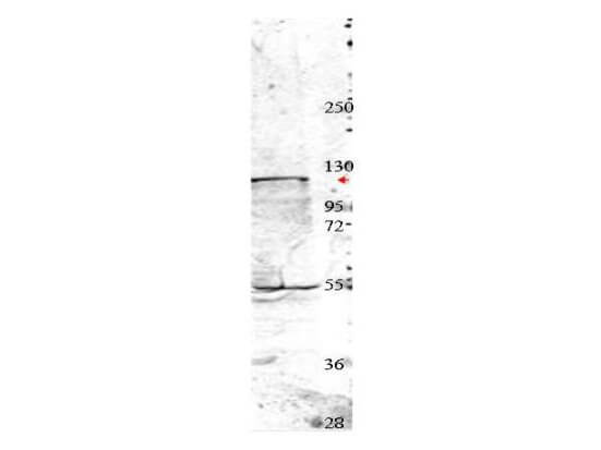 WB - Anti-NEDD4 (RABBIT) Antibody ASR5449