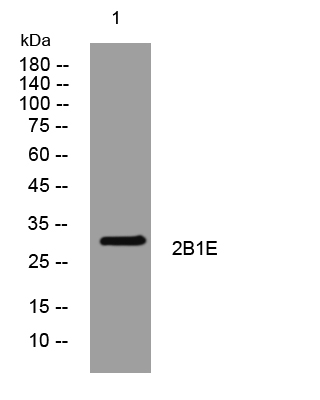 WB - 2B1E Rabbit Polyclonal Antibody AP93450