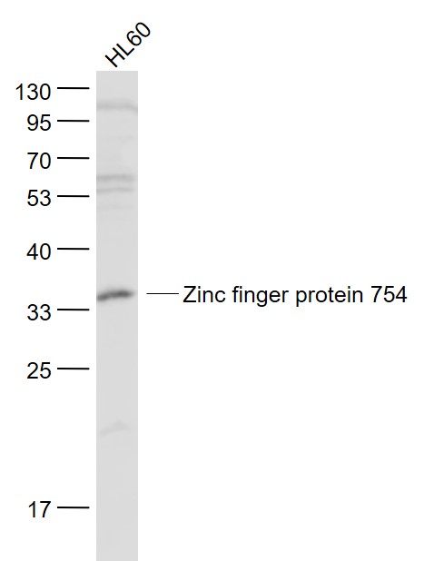 WB - Zinc finger protein 754 Rabbit pAb AP94273