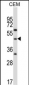 CBLC Antibody (N-term)