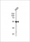 PDX1 Antibody (C-term)