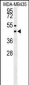 SUV39H1 Antibody