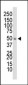 DOK1 Antibody (N-term)