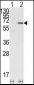 DOK1 Antibody (N-term)