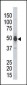 PHKG2 Antibody (N-term)