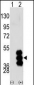 PHKG2 Antibody (N-term)