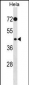 PHKG2 Antibody (N-term)