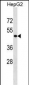 PHKG2 Antibody (Center)