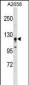 STK31 Antibody (N-term)