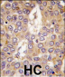 CSNK1G2 Antibody (C-term)