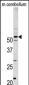 PFTK1 Antibody (N-term)