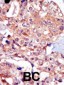 TRPM7 (CHAK1) Antibody (N-term)