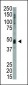 KIST (KIS) Antibody (N-term)