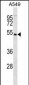 KIST (KIS) Antibody (N-term)