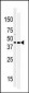 MOS Antibody (N-term)