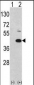 MOS Antibody (N-term)