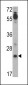 CRIPTO (TDGF1) Antibody (N-term)