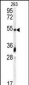 GDF10 Antibody (N-term)