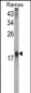 UBE2B Antibody (C-term)