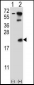 UBE2B Antibody (C-term)