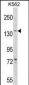 AGL Antibody (Center)