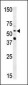 NMT2 Antibody (N-term)