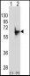 NMT2 Antibody (N-term)