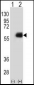 NMT2 Antibody (N-term)