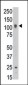 ABCB6 Antibody (C-term)