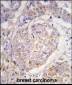 MAGEA10 Antibody (C-term)