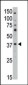 MAGEA10 Antibody (C-term)