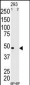 MAGEA11 Antibody (N-term)