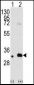 MAGEB2 Antibody (N-term)