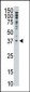 MAGEF1 Antibody (C-term)