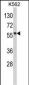 MMP19 Antibody (C-term)