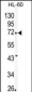 MMP24 Antibody (Center)