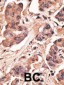 MAGEH1 Antibody (C-term)