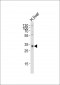 SULT2A Antibody (C-term)